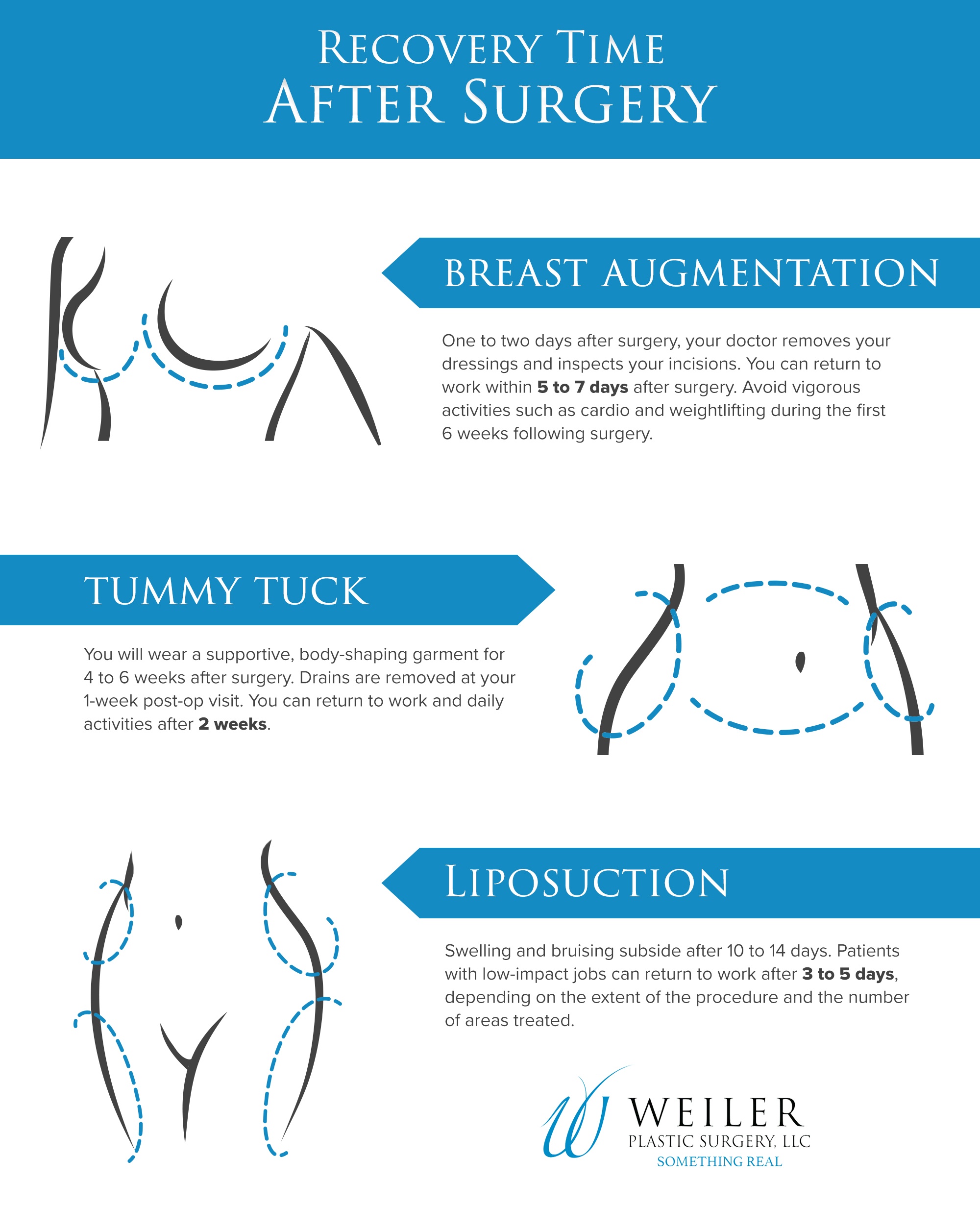 tummy tuck recovery timeline