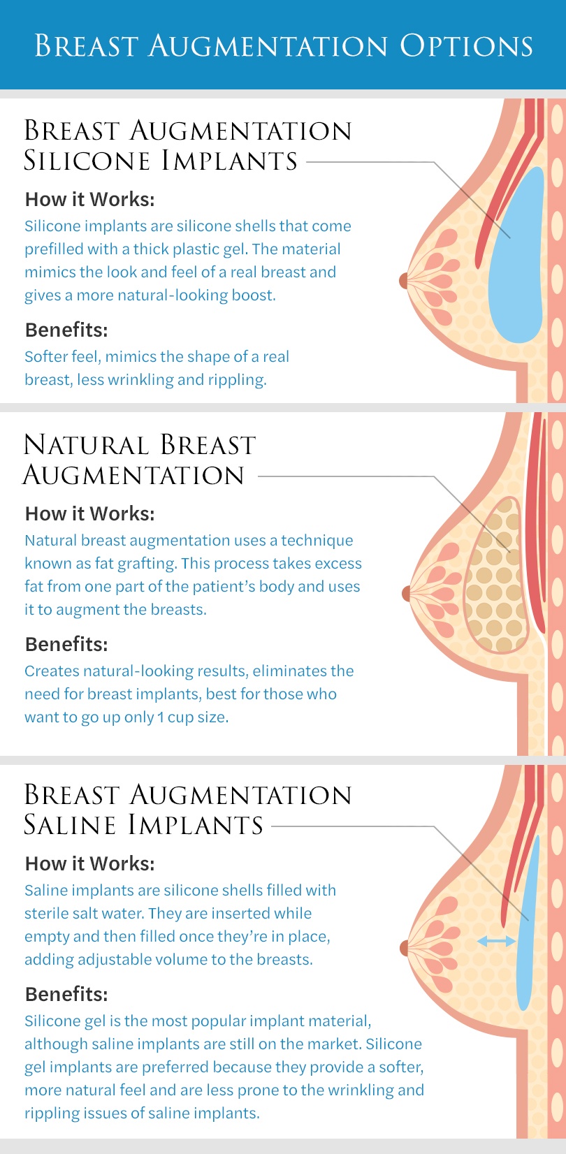 Breast Implants: Size, Shape, Cost & More. A Baton Rouge Surgeon Explains  It All