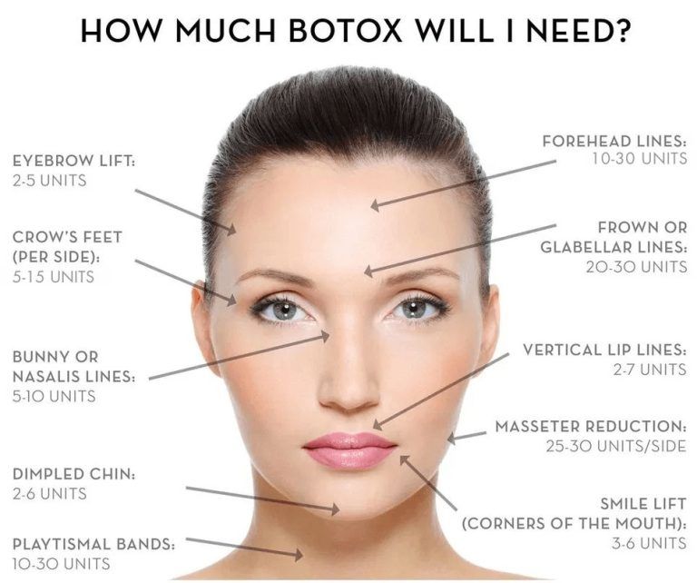 How Many Units of BOTOX® Do I Need? – Weiler Plastic Surgery Group