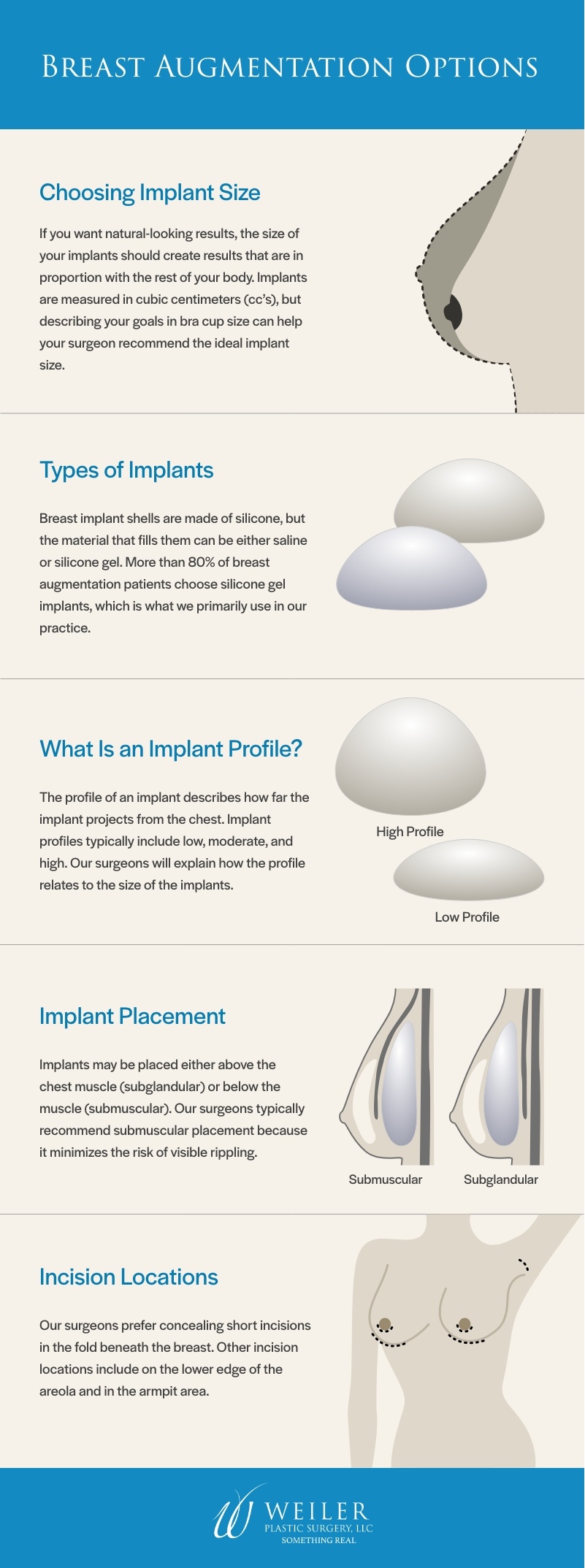 All about breast implant profiles