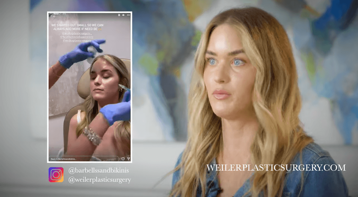 Allison Jones Social Media Influencer Testimonial Weiler Plastic Surgery Weiler Plastic 